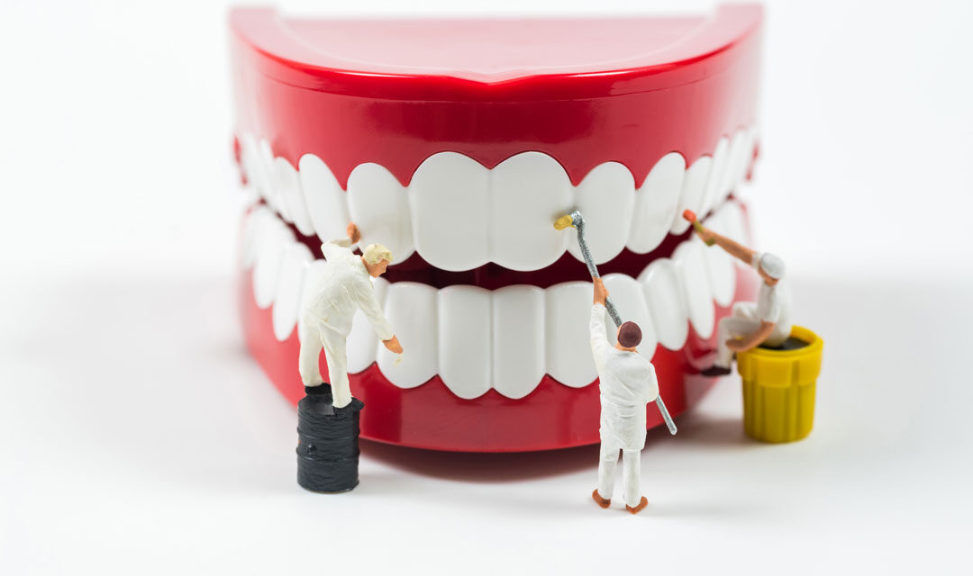 Diş Taşı Temizliği, Diş Taşı Temizliği Fiyatı