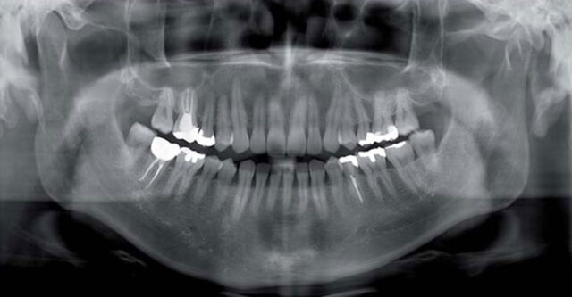 Oral diagnoz