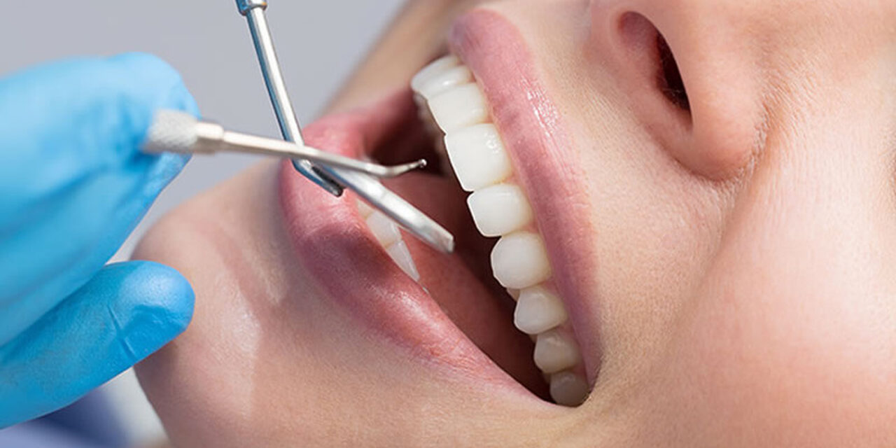 Diş Dolgusu Nasıl Yapılır ?