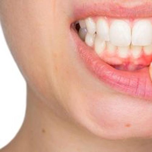 Diş Ağrısı ve Apseli Diş: Tedavi ve Müdahale Yöntemleri
