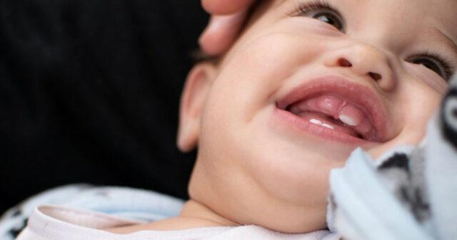 Bebeklerde diş eti şişmesi ve nedenleri